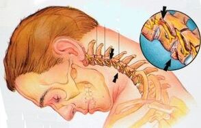 The cervical department